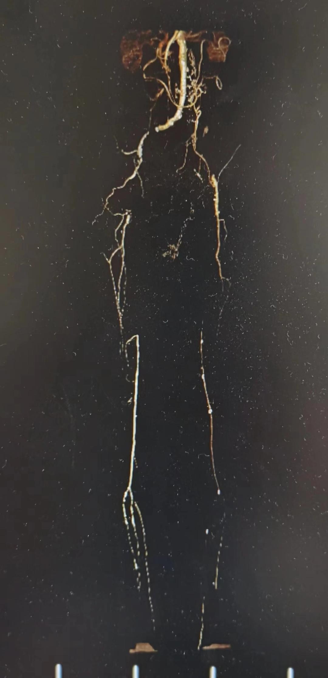 DƬ